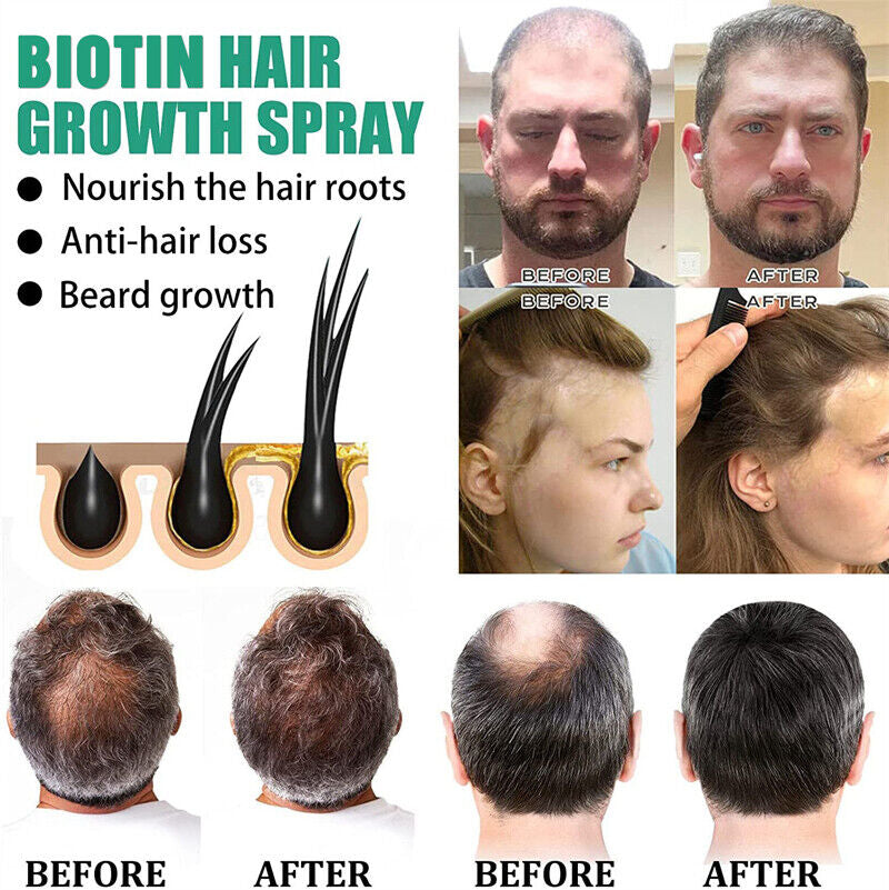 2024 Biotin Premium Hair Growth Serum, Biotin Hair Growth Spray, Biotin Thick...